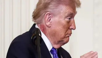 Njolla e madhe e kuqe në qafën e Trump, i tremb amerikanët më shumë se Irani