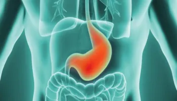 Problemet me aciditetin e stomakut gjatë agjërimit, ja si ta mbani nën kontroll dhe pa pasur shqetësime