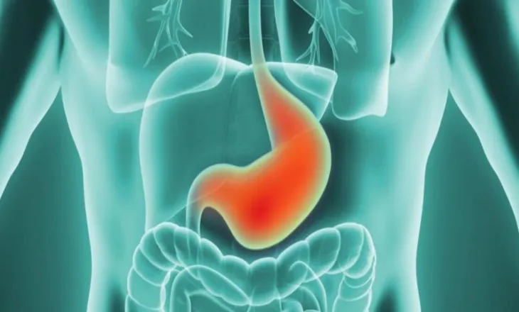 Problemet me aciditetin e stomakut gjatë agjërimit, ja si ta mbani nën kontroll dhe pa pasur shqetësime