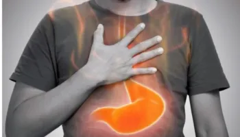 Refluksi gastroezofageal, si ta menaxhojmë përmes ushqimit dhe stilit të jetesës