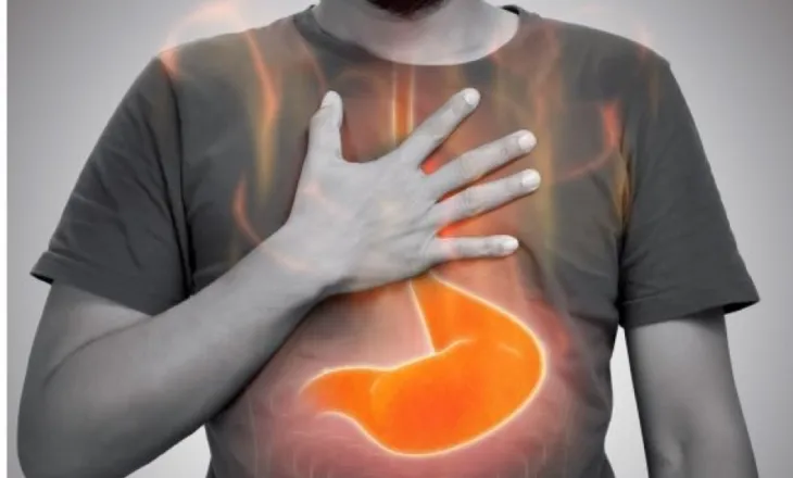 Refluksi gastroezofageal, si ta menaxhojmë përmes ushqimit dhe stilit të jetesës