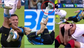 Shokuese në Brazil, thyen kyçin e këmbës dhe përfundon në spital. Dëmtimi i tmerrshëm i tremb të gjithë (foto+video)