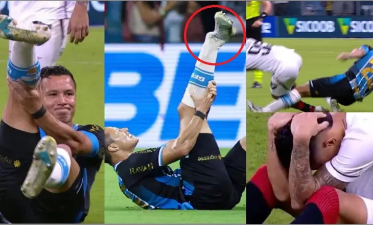 Shokuese në Brazil, thyen kyçin e këmbës dhe përfundon në spital. Dëmtimi i tmerrshëm i tremb të gjithë (foto+video)