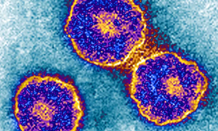 Shytat mund të rikthehen. Jo vetëm fruthi është në rritje