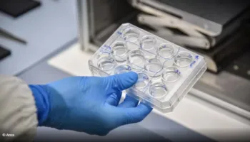 Tre Pap teste rezultuan negativë, shqiptarja vdes nga kanceri, familja dëmshpërblehet me 300 mijë euro