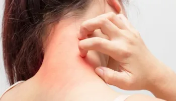 Ju kruhet trupi pa arsye? Epo nuk është plotësisht ashtu, ja çfarë fshihet