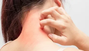 Ju kruhet trupi pa arsye? Epo nuk është tamam ashtu, ja çfarë fshihet