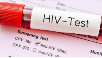 Raporti i HIV: Shqipëria përballë një vale të re infeksionesh, rekord që nga 2016-a