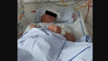 59-vjeçarja shqiptare pëson hemorragji cerebrale dhe mbetet në Danimarkë, familja kërkon mbështetje për ta shpëtuar