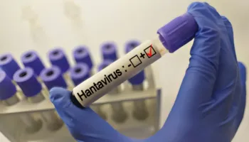 Hantavirusi, OBSH paralajmëron: Javët e ardhshme ‘shpërthim’ rastesh