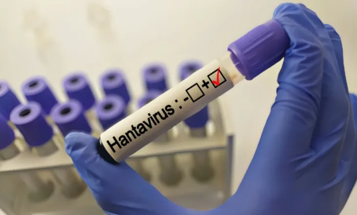 Hantavirusi, OBSH paralajmëron: Javët e ardhshme ‘shpërthim’ rastesh