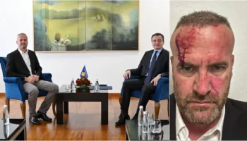 “Jam sulmuar nga banda e tij, më morën…”/ Dhunohet kreu i degës së LVV-së në Skënderaj, akuzon kryetarin e komunës