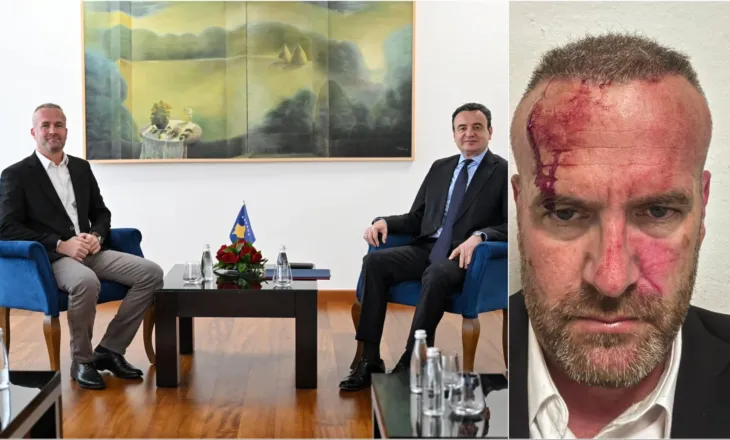 “Jam sulmuar nga banda e tij, më morën…”/ Dhunohet kreu i degës së LVV-së në Skënderaj, akuzon kryetarin e komunës