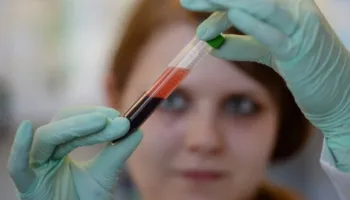 Një test gjaku mund të zbulojë sëmundjet e zemrës dhe veshkave më herët se kurrë