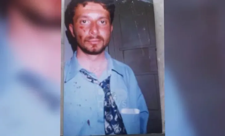 “S’kam parë kurrë aq shumë fytyra me gjak”, Braçe rikthen pamjet e dhunës ndaj opozitës në 1996