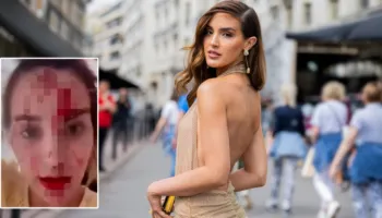 Skandal në Kanë/ Miss Venezuela publikon videon tronditëse me fytyrën e mbuluar në gjak, akuzon stilistin e njohur për dhunë