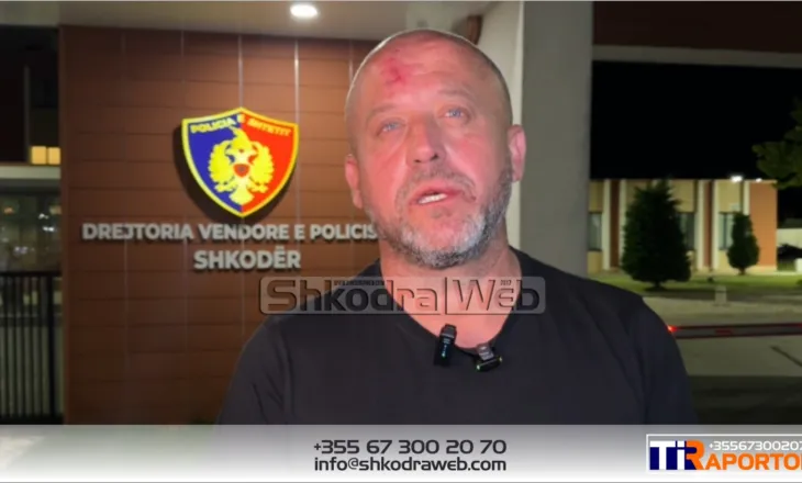 VIDEO – Arrestohet 51- vjeçari, pronar i rrjetit të marketeve në Shkodër, goditi gazetarin Ervin Dushi