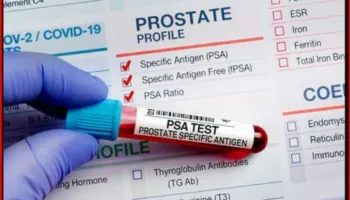 Ilaçi i ri ul rikthimin e kancerit të prostatës