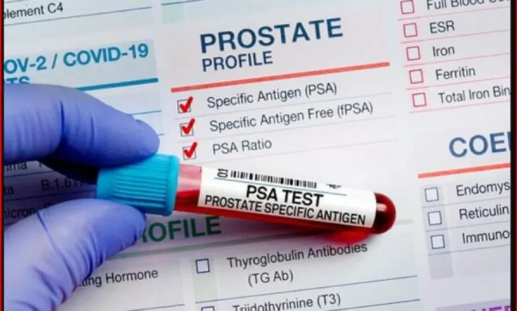 Ilaçi i ri ul rikthimin e kancerit të prostatës