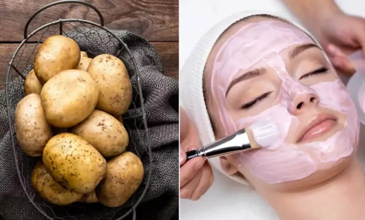 Mos i hidhni lëkurat e patates, bëjnë mrekulli për fytyrën; Si t’i përdorni
