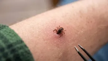 Rriqrat dhe rreziku i fshehtë: alergjia e rrezikshme ndaj trupit