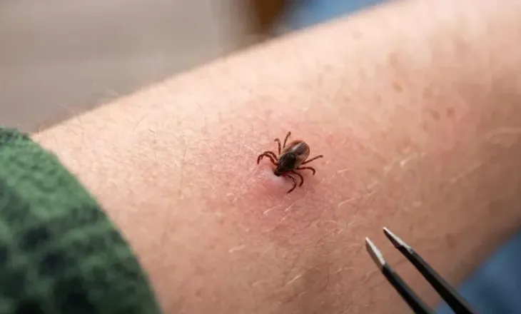 Rriqrat dhe rreziku i fshehtë: alergjia e rrezikshme ndaj trupit