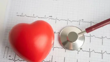 Si të përgatiteni për një EKG dhe çfarë mund të tregojë ajo