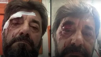 Analisti i dhunuar sqaron ngjarjen: Thanë se kisha lajmëruar policinë për…