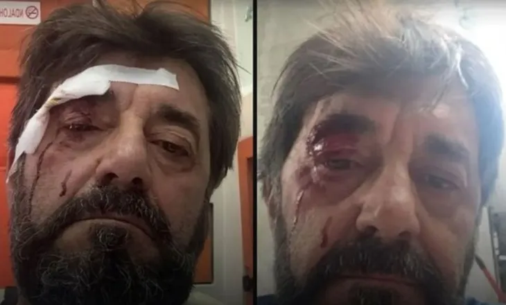 Analisti i dhunuar sqaron ngjarjen: Thanë se kisha lajmëruar policinë për…