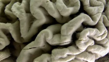 Analiza e gjakut zbulon rrezikun për Alzheimer