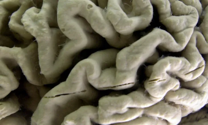 Analiza e gjakut zbulon rrezikun për Alzheimer