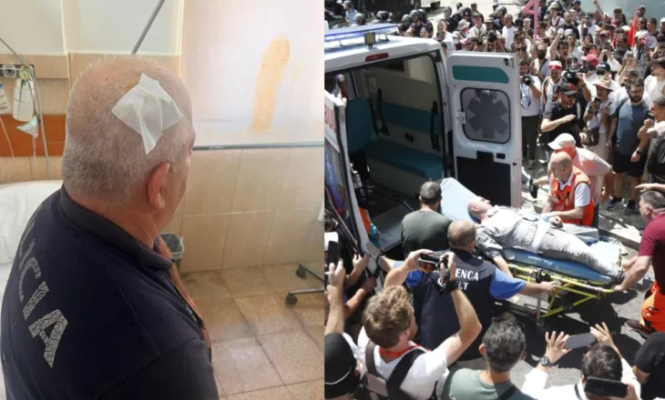 Dhuna para Parlamentit, 11 protestues dhe 6 efektivë paraqiten në QSUT dhe te Trauma, ja gjendja e tyre