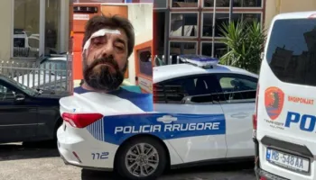 Dhunimi i Ilir Demaliajt, policia: Është shpallur në kërkim autori i dyshuar