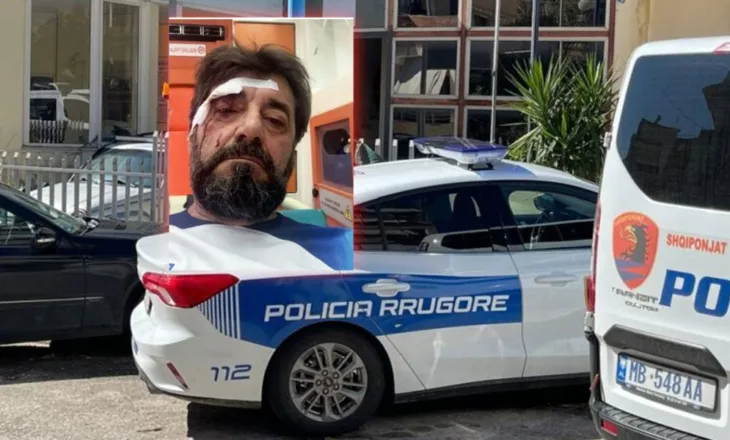Dhunimi i Ilir Demaliajt, policia: Është shpallur në kërkim autori i dyshuar