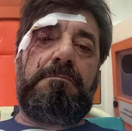 Dhunohet analisti Ilir Demalia