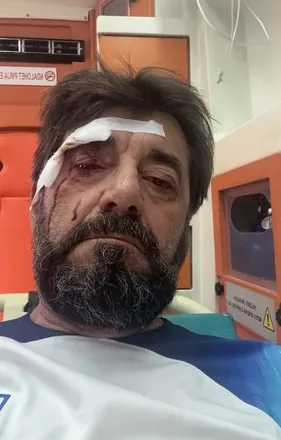 FOTO/ Dhunohet gazetari Ilir Demalia