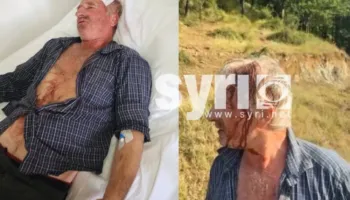 FOTO-EMRI/ Sherr mes fqinjëve në Tropojë, dhunohet 60-vjeçari, përfundon te Trauma në Tiranë