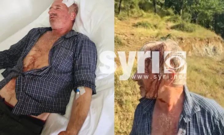 FOTO-EMRI/ Sherr mes fqinjëve në Tropojë, dhunohet 60-vjeçari, përfundon te Trauma në Tiranë