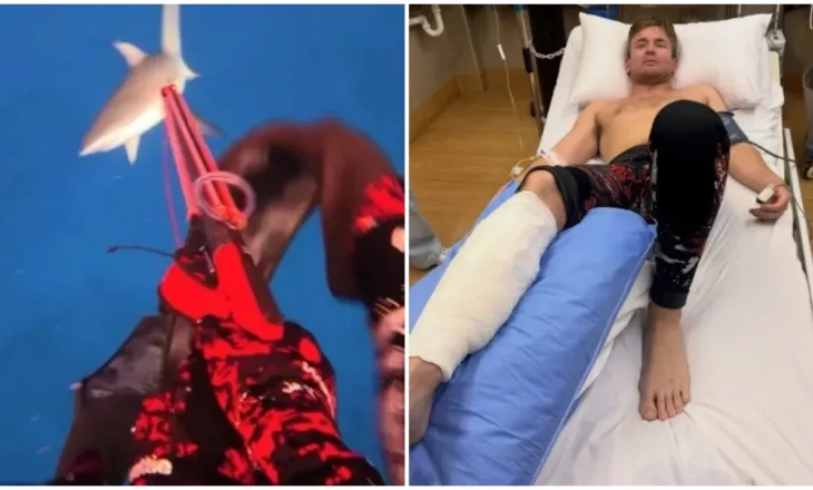 Peshkaqeni sulmon influencerin në Fixhi, i nënshtrohet katër operacioneve për të shpëtuar këmbën (VIDEO)