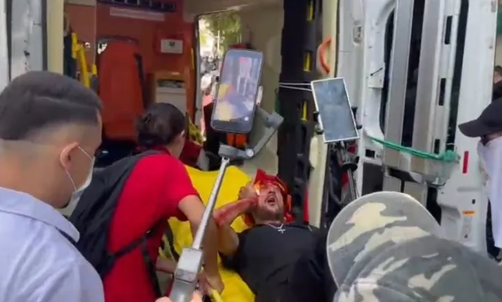 Protestuesi mbulohet me gjak nga plagët në kokë, transportohet me urgjencë drejt ambulancës