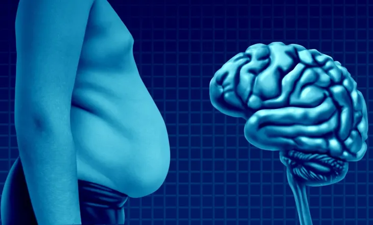 Shkencëtarët zbulojnë se si obeziteti mund të nxisë sëmundjen e Alzheimerit