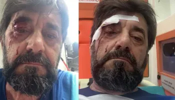 Sulmohet egërsisht analisti dhe publicisti i njohur Ilir Demalia: Këta janë cuba, në sy të policit bënë një dhunë të tillë