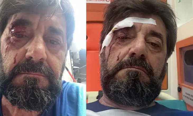 Sulmohet egërsisht analisti dhe publicisti i njohur Ilir Demalia: Këta janë cuba, në sy të policit bënë një dhunë të tillë