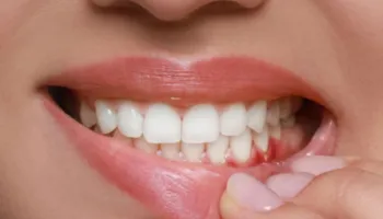 20 shenja që tregojnë se vizita te dentisti nuk duhet të shtyhet