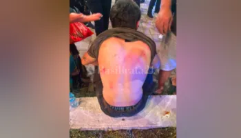 6 italianët e dhunuar në Tiranë, policia: Turistët nuk pranuan të bënin kallëzim!