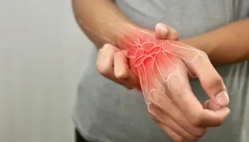 Ajri i ndotur mund të shkaktojë përkeqësime të dhimbshme të artritit reumatoid