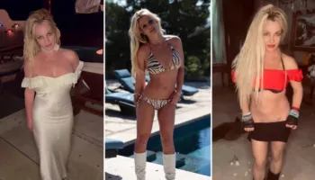 Britney Spears në shok pas trajtimit estetik: “Më shkatërruan fytyrën, mos u besoni!”