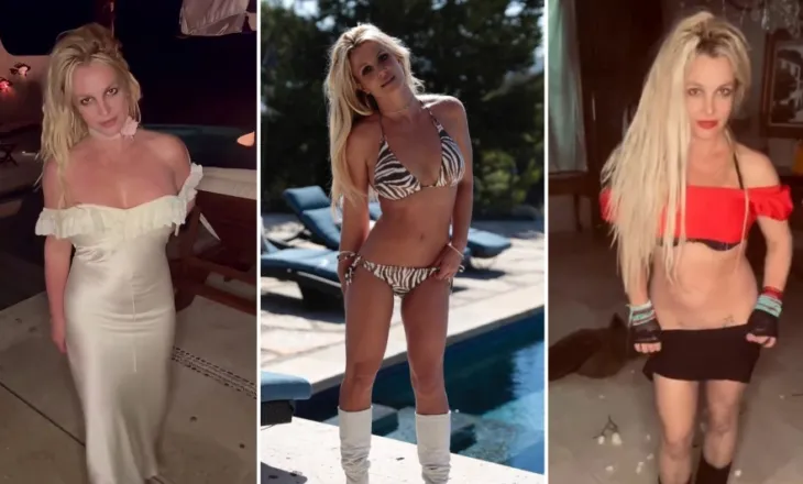 Britney Spears në shok pas trajtimit estetik: “Më shkatërruan fytyrën, mos u besoni!”