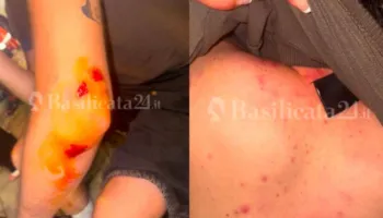 Denoncimi i turistëve italianë për dhunë/ Policia: U përfshinë në konflikt…