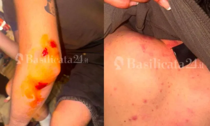 Denoncimi i turistëve italianë për dhunë/ Policia: U përfshinë në konflikt…